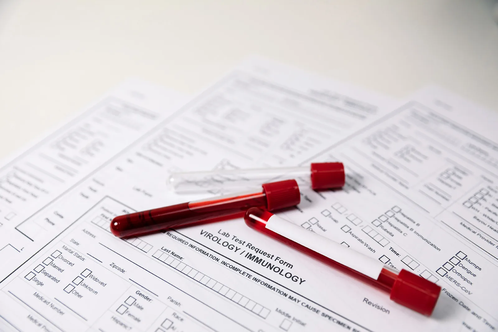 Reagenzgläser und Laborauftrag – zuverlässige Analysen im Demetra Labor